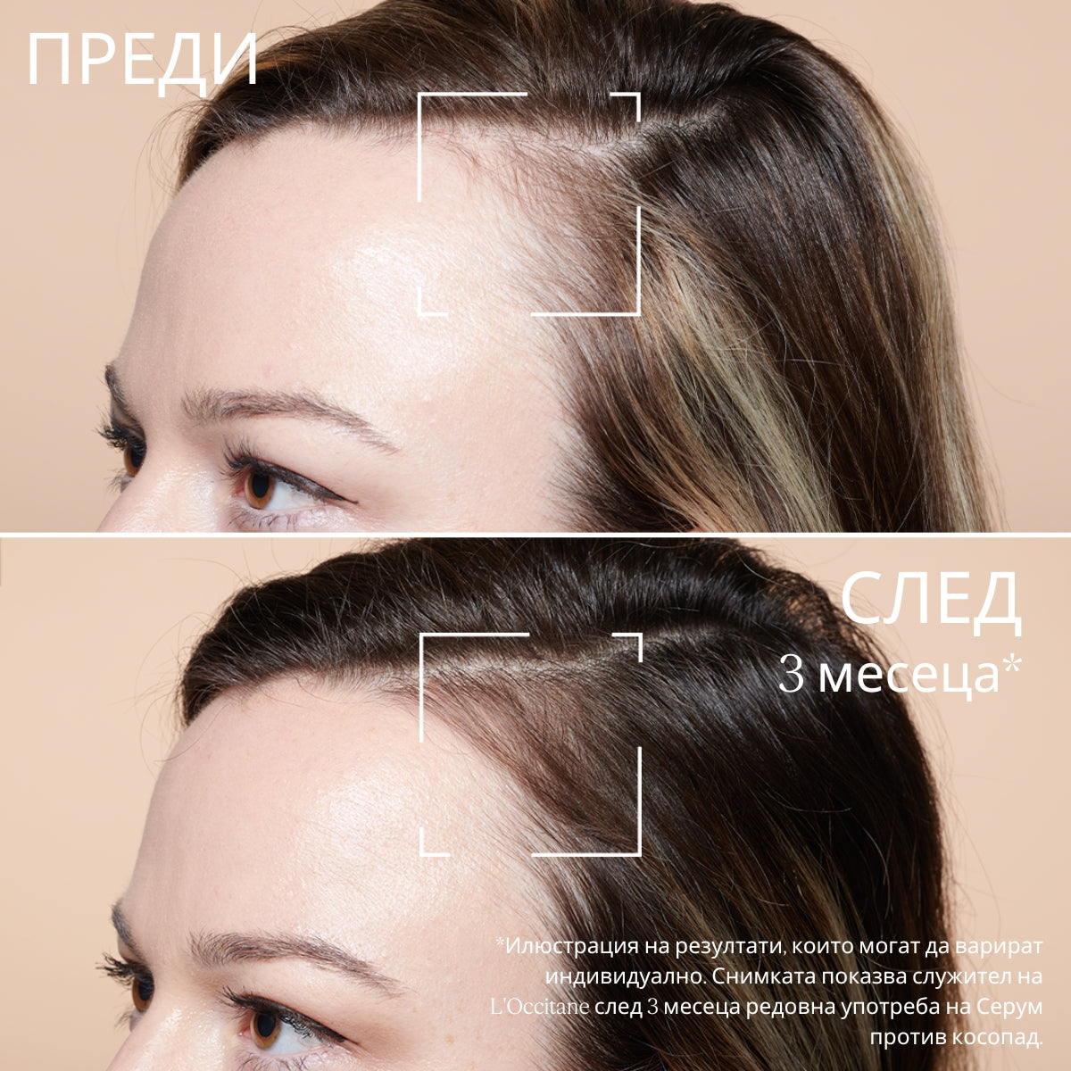 Двуфазен серум срещу косопад