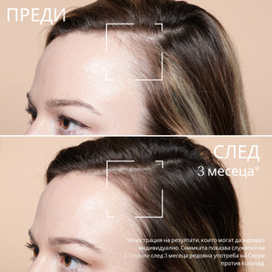 Двуфазен серум срещу косопад